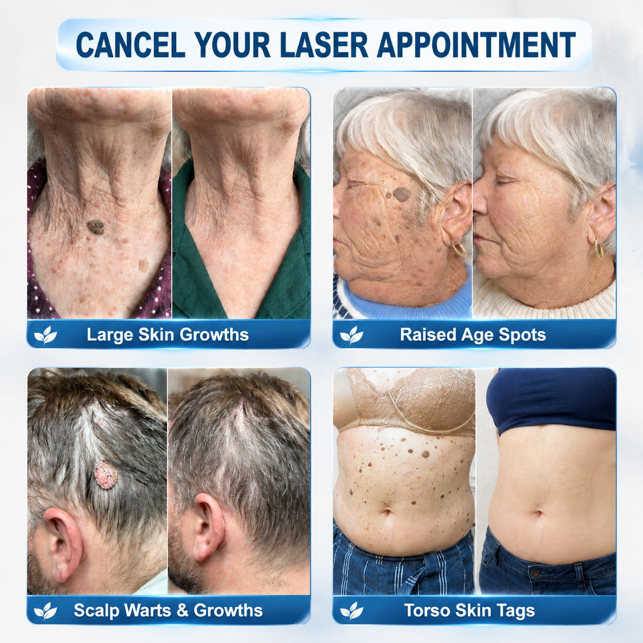 𝐇𝐈𝐒𝐊𝐈𝐍®🌟 𝟕-𝐃𝒂𝘆 𝐒𝗸𝐢𝐧 𝐓𝒂𝗴 & 𝐒𝐩𝙤𝐭 𝐄𝐫𝒂𝐬𝙚𝐫